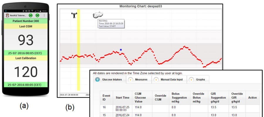 Monitoring glukózy